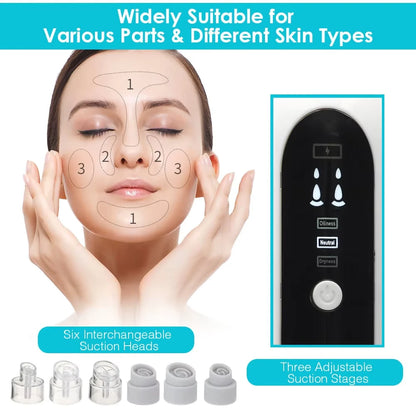 Electric Vacuum Blackhead Acne Pore Cleaner