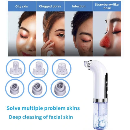 Electric Vacuum Blackhead Acne Pore Cleaner