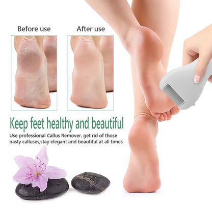 Rechargeable Electric Foot File — Callus Remover abzalux