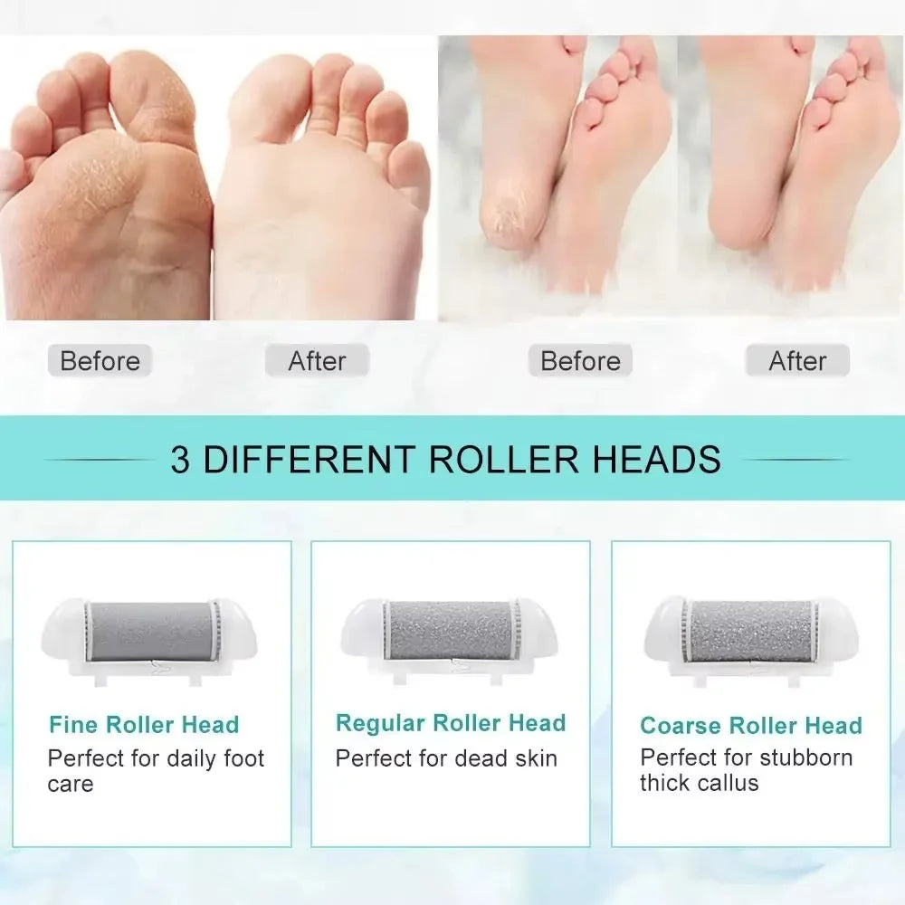 Rechargeable Electric Foot File — Callus Remover abzalux