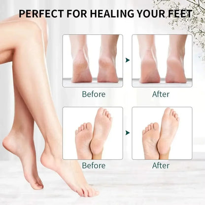 Rechargeable Electric Foot Callus Remover